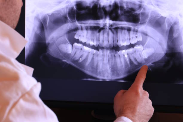 Best Emergency Root Canal Treatment in Newport News, VA