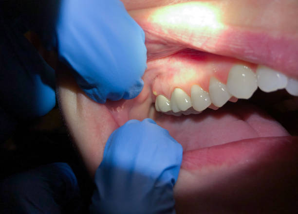 Best Weekend Emergency Dentist in Newport News, VA